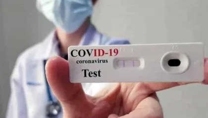 test sierologici covid coronavirus scuole