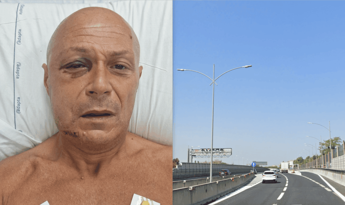 ROMA EST - “Io, travolto sull’A24: aiutatemi a individuare il pirata della strada”